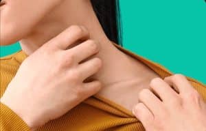 what is mometasone furoate lotion used for